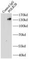 RNA Polymerase II Subunit B antibody, FNab06620, FineTest, Immunoprecipitation image 