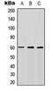 Bone Morphogenetic Protein Receptor Type 1A antibody, LS-C354568, Lifespan Biosciences, Western Blot image 