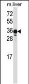 LIM Zinc Finger Domain Containing 2 antibody, PA5-48603, Invitrogen Antibodies, Western Blot image 