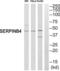 Serpin B4 antibody, abx014873, Abbexa, Western Blot image 