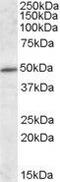 IFT57 antibody, GTX88435, GeneTex, Western Blot image 