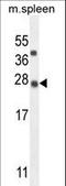 KIAA1143 antibody, LS-C165386, Lifespan Biosciences, Western Blot image 