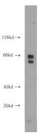 Retinoid Isomerohydrolase RPE65 antibody, FNab07401, FineTest, Western Blot image 