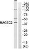 MAGE Family Member C2 antibody, TA315476, Origene, Western Blot image 