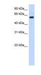Chromodomain Y-like protein antibody, NBP1-52986, Novus Biologicals, Western Blot image 