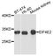 Eukaryotic Translation Initiation Factor 4E Family Member 2 antibody, A05869, Boster Biological Technology, Western Blot image 