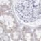Fibroblast Growth Factor Receptor Substrate 3 antibody, NBP1-83421, Novus Biologicals, Immunohistochemistry paraffin image 