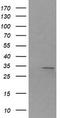 Retinoic Acid Receptor Responder 1 antibody, TA506088AM, Origene, Western Blot image 