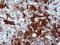 Serpin Family B Member 3 antibody, LS-C338251, Lifespan Biosciences, Immunohistochemistry frozen image 