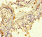 Rhophilin Associated Tail Protein 1 antibody, orb38576, Biorbyt, Immunohistochemistry paraffin image 