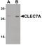 C-Type Lectin Domain Containing 7A antibody, PA5-34382, Invitrogen Antibodies, Western Blot image 