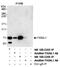 Fidgetin Like 1 antibody, NB100-2356, Novus Biologicals, Western Blot image 