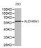 Aldehyde Dehydrogenase 6 Family Member A1 antibody, abx002356, Abbexa, Western Blot image 
