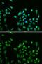 Baculoviral IAP Repeat Containing 7 antibody, GTX64543, GeneTex, Immunocytochemistry image 