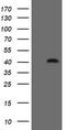 Zinc Finger C2HC-Type Containing 1A antibody, TA505121, Origene, Western Blot image 