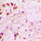 Hdm2 antibody, LS-C352508, Lifespan Biosciences, Immunohistochemistry frozen image 