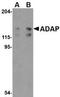 ADAP antibody, TA306450, Origene, Western Blot image 
