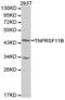 TNF Receptor Superfamily Member 11b antibody, LS-C192853, Lifespan Biosciences, Western Blot image 