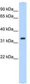 Neutrophil cytosol factor 4 antibody, TA338965, Origene, Western Blot image 