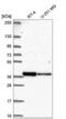 DTW Domain Containing 2 antibody, NBP2-58397, Novus Biologicals, Western Blot image 