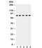 Carnitine Palmitoyltransferase 1B antibody, R32293, NSJ Bioreagents, Western Blot image 