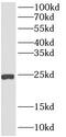 Anterior Gradient 3, Protein Disulphide Isomerase Family Member antibody, FNab00220, FineTest, Western Blot image 