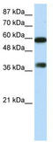 AT-rich interactive domain-containing protein 3B antibody, TA343610, Origene, Western Blot image 