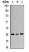 Tyrosine 3-Monooxygenase/Tryptophan 5-Monooxygenase Activation Protein Zeta antibody, orb318912, Biorbyt, Western Blot image 