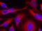 Protein Kinase D1 antibody, GTX50145, GeneTex, Immunofluorescence image 