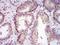 MICAL Like 1 antibody, H00085377-B01P, Novus Biologicals, Immunohistochemistry paraffin image 