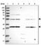 Flavin Adenine Dinucleotide Synthetase 1 antibody, NBP1-84752, Novus Biologicals, Western Blot image 