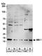 Prefoldin Subunit 5 antibody, A304-049A, Bethyl Labs, Western Blot image 
