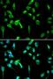 DNA Topoisomerase II Binding Protein 1 antibody, LS-C334288, Lifespan Biosciences, Immunofluorescence image 