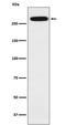 Spectrin alpha chain, erythrocyte antibody, M03376-1, Boster Biological Technology, Western Blot image 