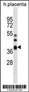 5'-Nucleotidase, Cytosolic IIIB antibody, 56-967, ProSci, Western Blot image 
