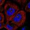 Chromosome 11 Open Reading Frame 80 antibody, NBP1-93944, Novus Biologicals, Immunofluorescence image 