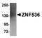 Zinc finger protein 536 antibody, A14403, Boster Biological Technology, Western Blot image 