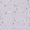 Centrosomal Protein 72 antibody, PA5-63537, Invitrogen Antibodies, Immunohistochemistry frozen image 