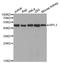 Ribosomal Protein L3 antibody, STJ25397, St John