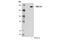 Lysine-specific demethylase 2B antibody, 44570S, Cell Signaling Technology, Western Blot image 