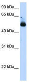 SS-A antibody, TA335783, Origene, Western Blot image 