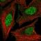Homeobox protein Hox-D3 antibody, HPA063671, Atlas Antibodies, Immunocytochemistry image 