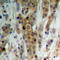 Akt antibody, LS-C358910, Lifespan Biosciences, Immunohistochemistry paraffin image 