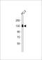Integrin Subunit Alpha 3 antibody, M02902-1, Boster Biological Technology, Western Blot image 