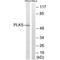 Serine/threonine-protein kinase PLK5 antibody, PA5-50128, Invitrogen Antibodies, Western Blot image 