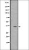 Palmitoyl-Protein Thioesterase 1 antibody, orb336791, Biorbyt, Western Blot image 