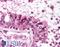 Melanoma-associated antigen C1 antibody, LS-B892, Lifespan Biosciences, Immunohistochemistry paraffin image 