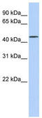 Leucine Rich Repeat Containing 28 antibody, TA340334, Origene, Western Blot image 