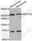 SET Domain Containing 1B, Histone Lysine Methyltransferase antibody, A2300, ABclonal Technology, Western Blot image 