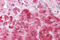 Nucleolar protein 3 antibody, 25-365, ProSci, Immunohistochemistry paraffin image 